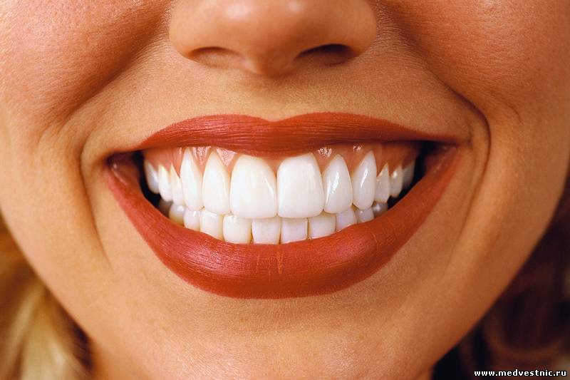 Почему отбеливание зубов нужно консультировать у стоматолога?
